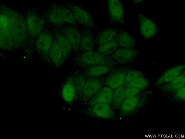 ZNF451 Antibody in Immunocytochemistry (ICC/IF)