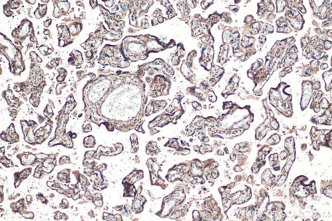 ZNF451 Antibody in Immunohistochemistry (Paraffin) (IHC (P))