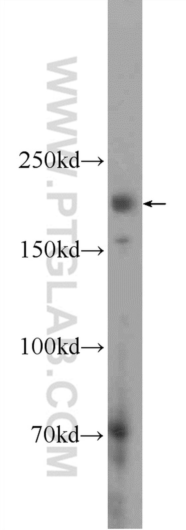 KIAA0430 Antibody in Western Blot (WB)