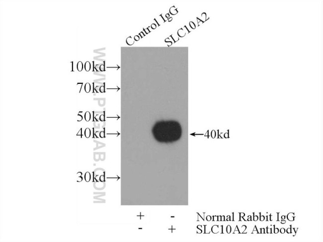 ASBT Antibody in Immunoprecipitation (IP)