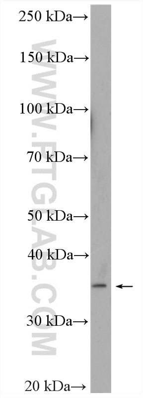 ASBT Antibody in Western Blot (WB)