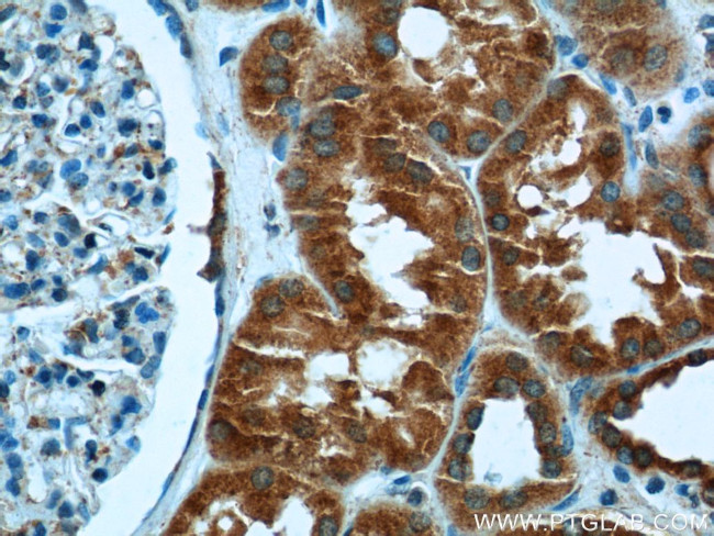 C6orf130 Antibody in Immunohistochemistry (Paraffin) (IHC (P))