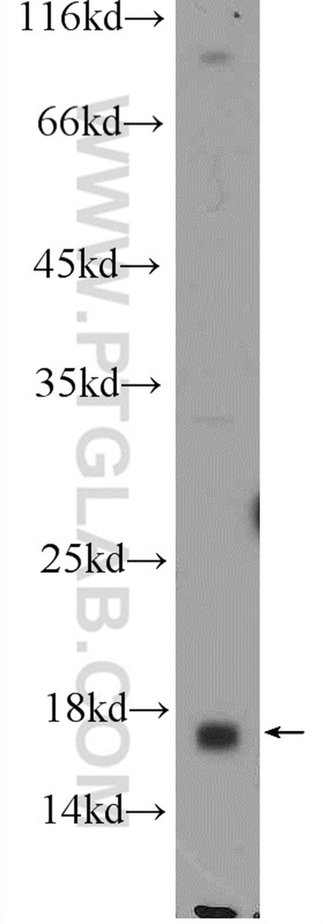 C6orf130 Antibody in Western Blot (WB)