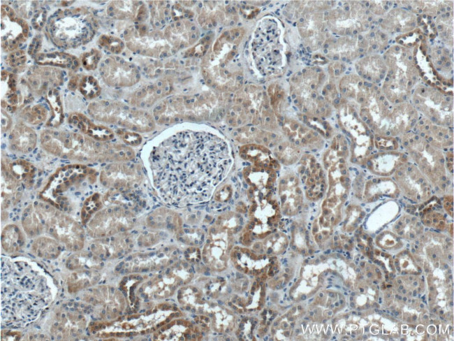 TBC1D24 Antibody in Immunohistochemistry (Paraffin) (IHC (P))