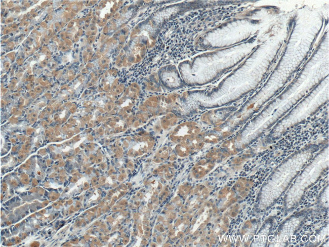 TBC1D24 Antibody in Immunohistochemistry (Paraffin) (IHC (P))