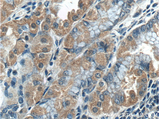 TBC1D24 Antibody in Immunohistochemistry (Paraffin) (IHC (P))