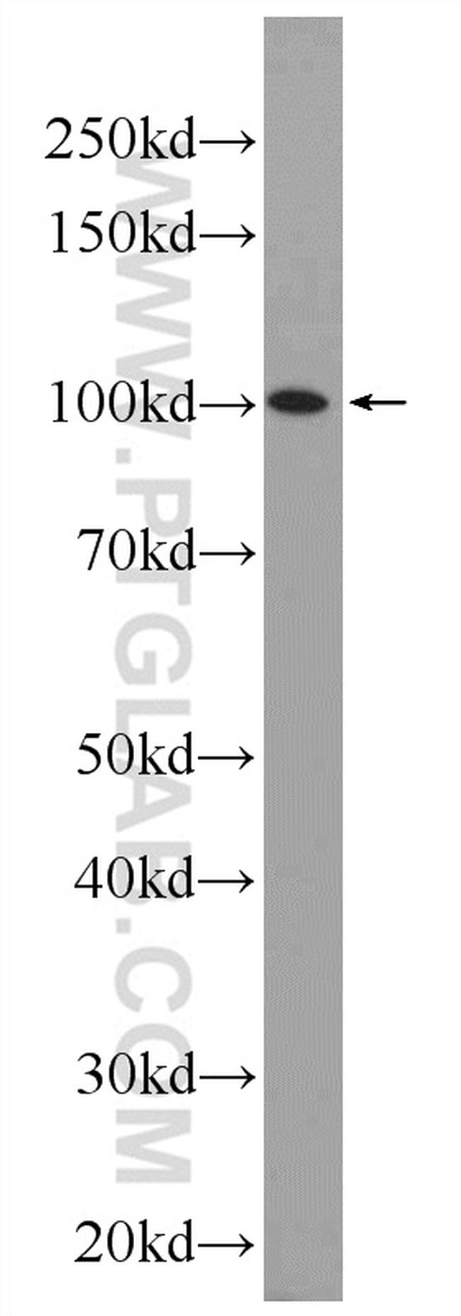 SFMBT2 Antibody in Western Blot (WB)