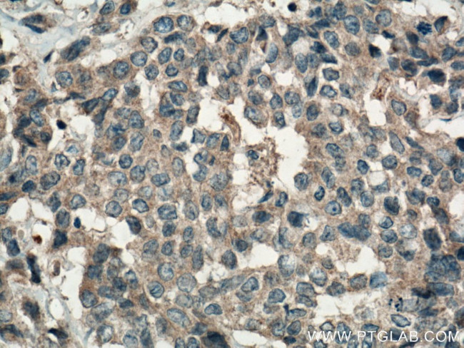 FAM20A Antibody in Immunohistochemistry (Paraffin) (IHC (P))