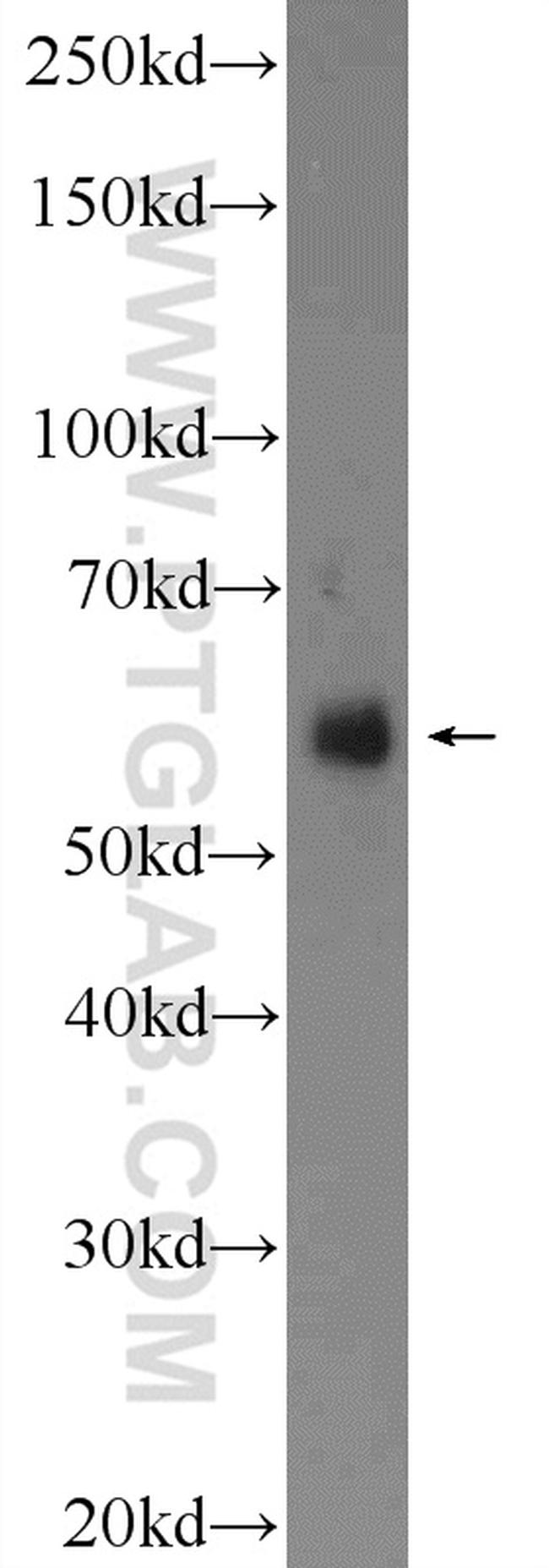 VGLUT2 Antibody in Western Blot (WB)