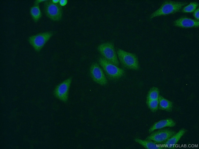 UAP1L1 Antibody in Immunocytochemistry (ICC/IF)