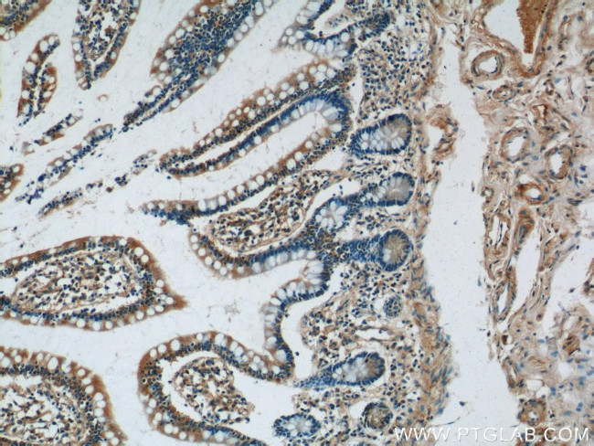 GPR44 Antibody in Immunohistochemistry (Paraffin) (IHC (P))