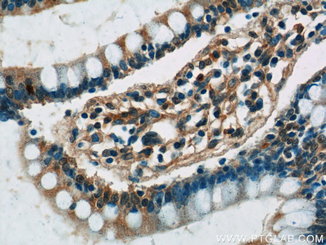 GPR44 Antibody in Immunohistochemistry (Paraffin) (IHC (P))