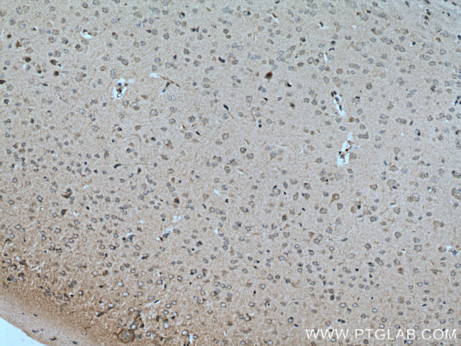 CRHR2 Antibody in Immunohistochemistry (Paraffin) (IHC (P))