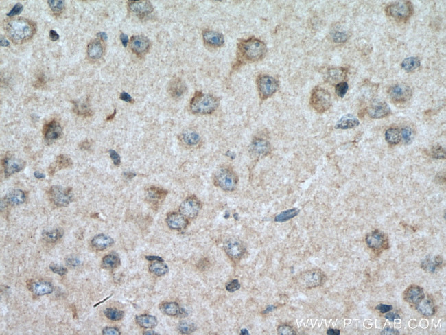 CRHR2 Antibody in Immunohistochemistry (Paraffin) (IHC (P))