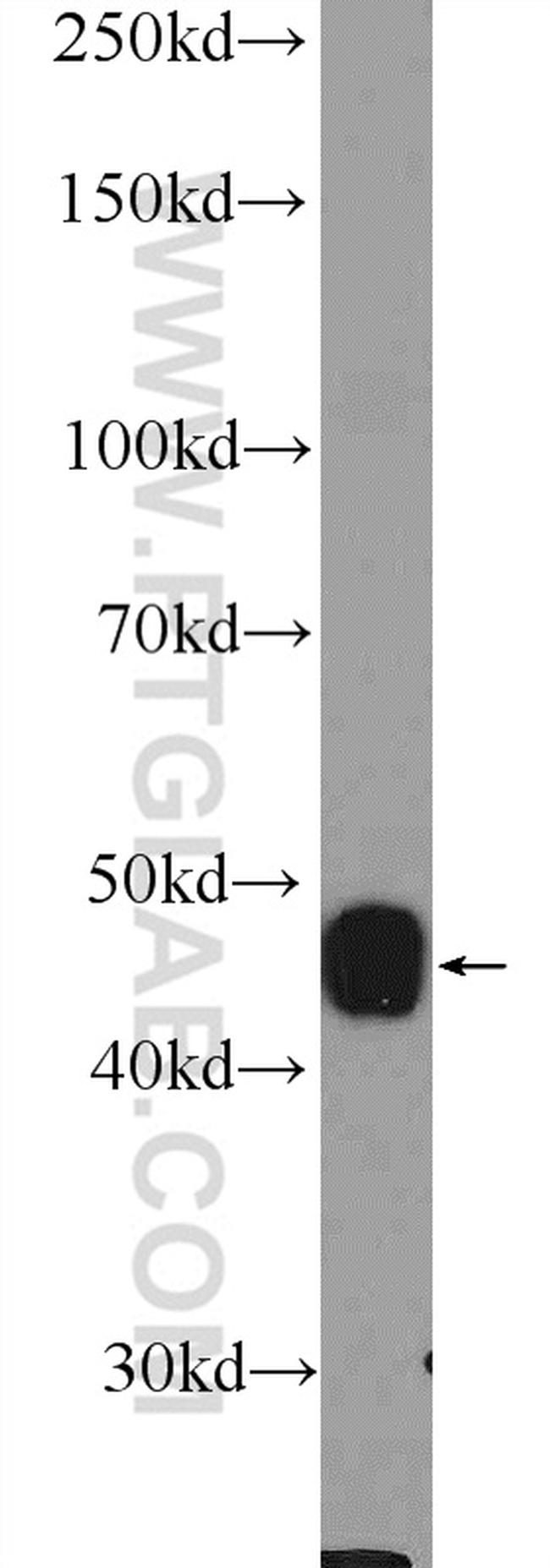 CRHR2 Antibody in Western Blot (WB)