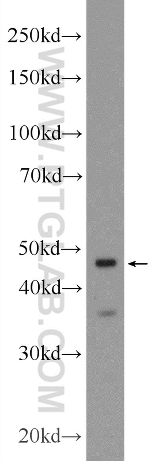 CRHR2 Antibody in Western Blot (WB)