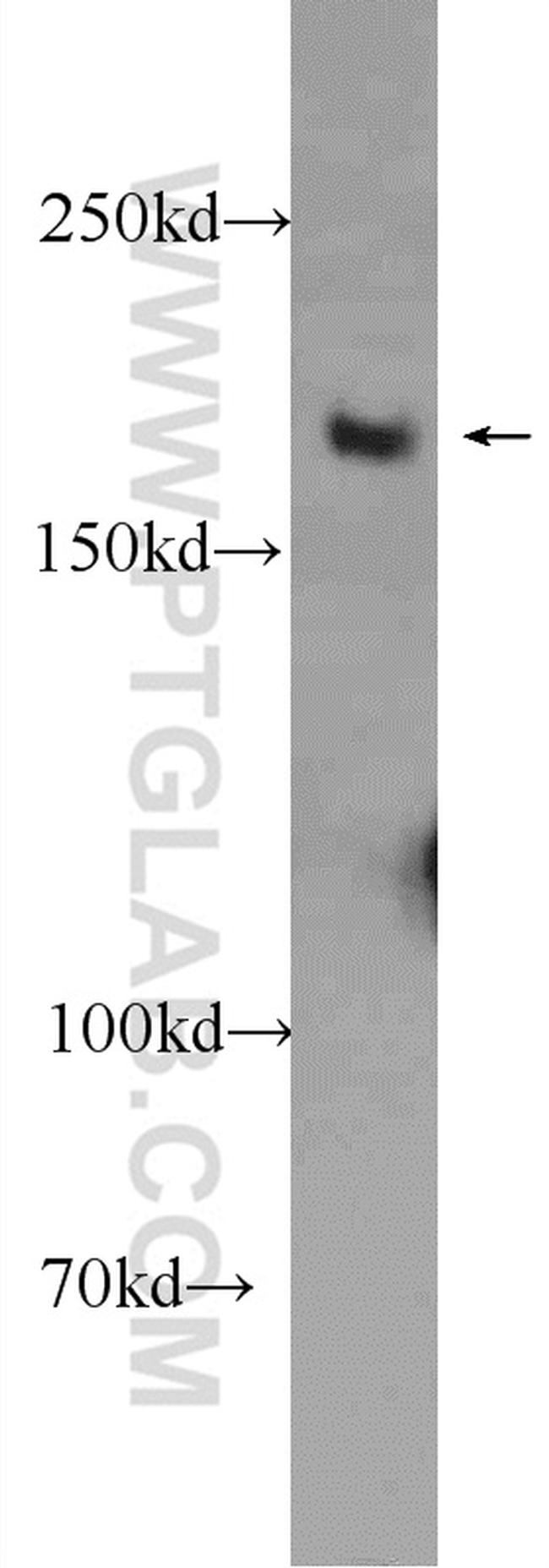 WRN Antibody in Western Blot (WB)