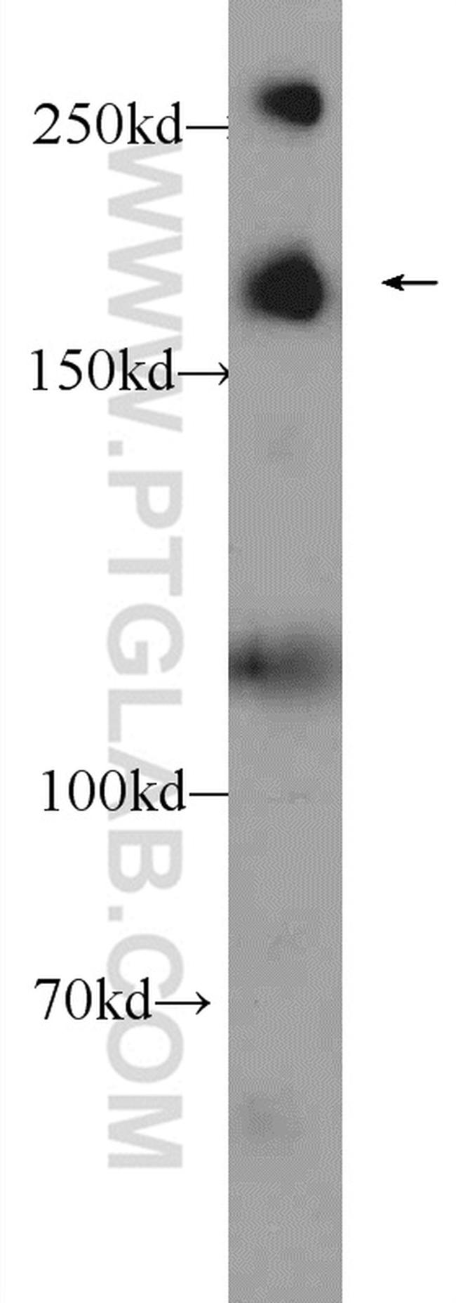 WRN Antibody in Western Blot (WB)