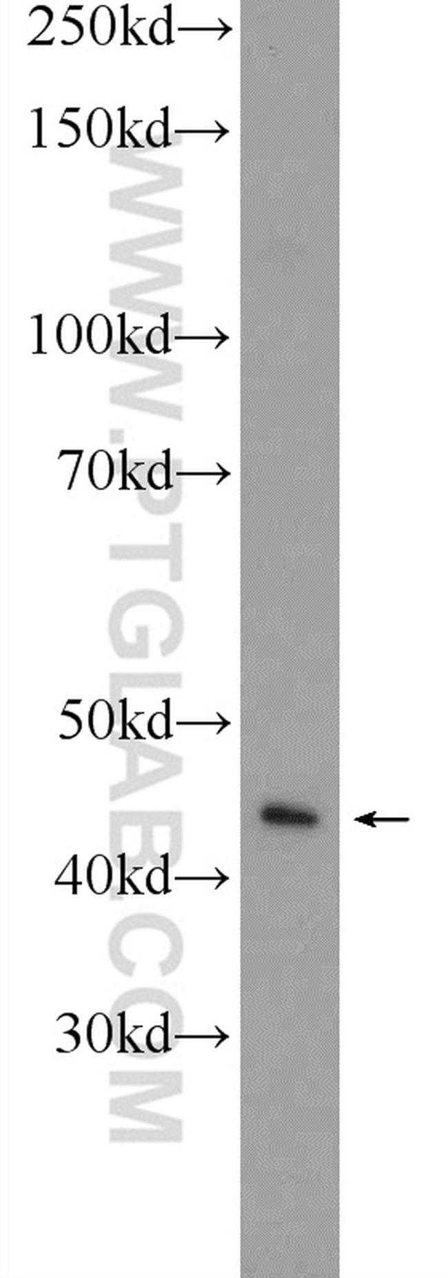 TACR2 Antibody in Western Blot (WB)