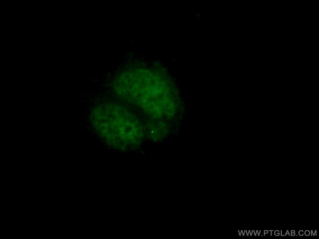 PHOX2B Antibody in Immunocytochemistry (ICC/IF)