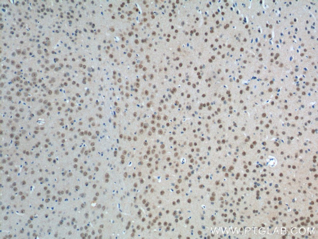 PHOX2B Antibody in Immunohistochemistry (Paraffin) (IHC (P))