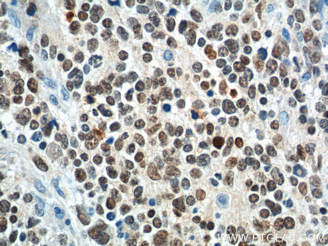 PHOX2B Antibody in Immunohistochemistry (Paraffin) (IHC (P))