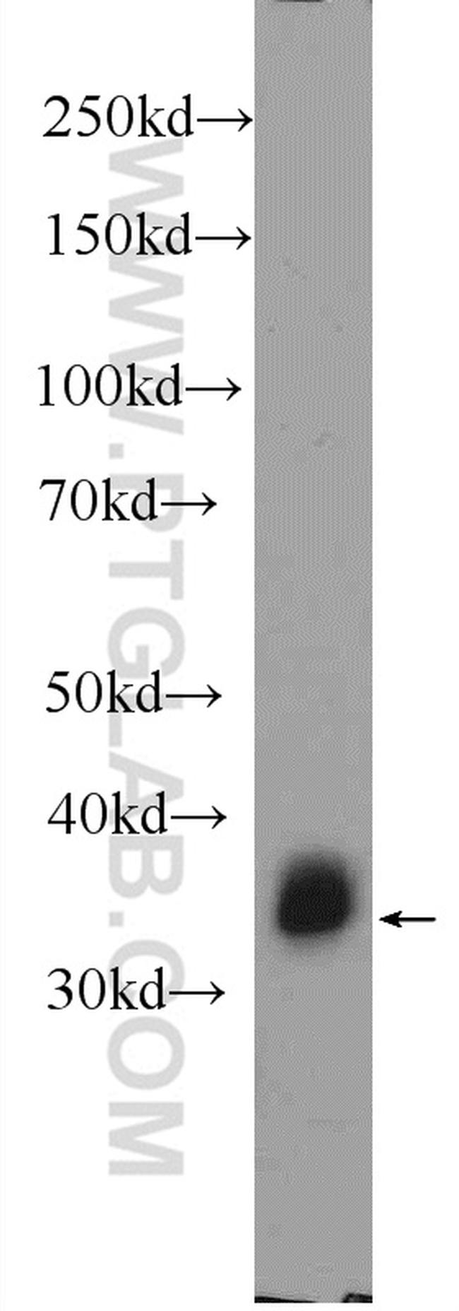 PHOX2B Antibody in Western Blot (WB)