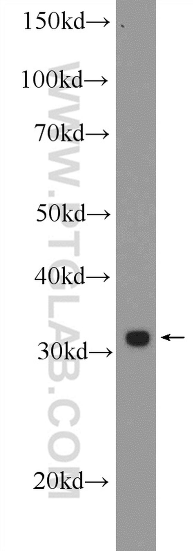 PHOX2B Antibody in Western Blot (WB)