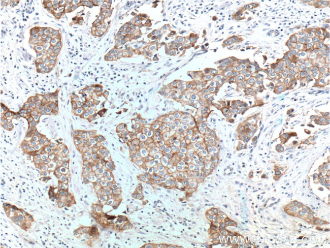 Integrin beta-4 Antibody in Immunohistochemistry (Paraffin) (IHC (P))