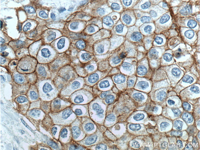 Integrin beta-4 Antibody in Immunohistochemistry (Paraffin) (IHC (P))