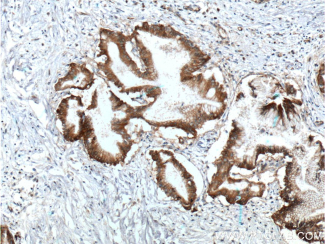 Integrin beta-4 Antibody in Immunohistochemistry (Paraffin) (IHC (P))