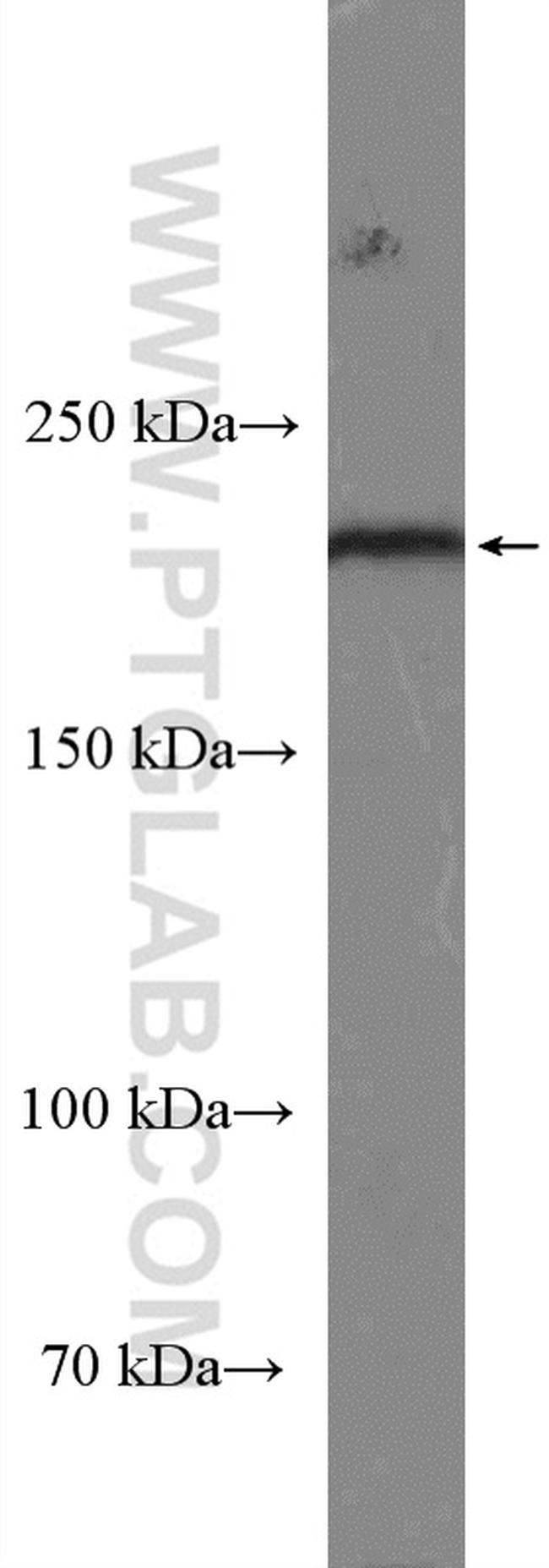 Integrin beta-4 Antibody in Western Blot (WB)