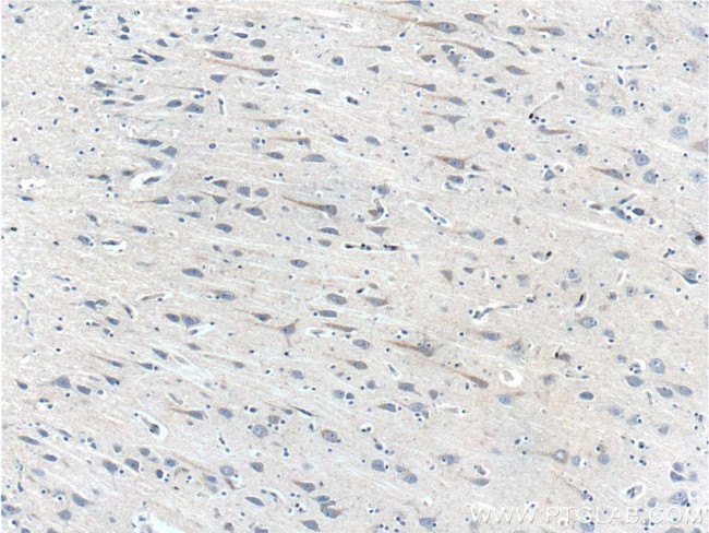 PRTN3 Antibody in Immunohistochemistry (Paraffin) (IHC (P))