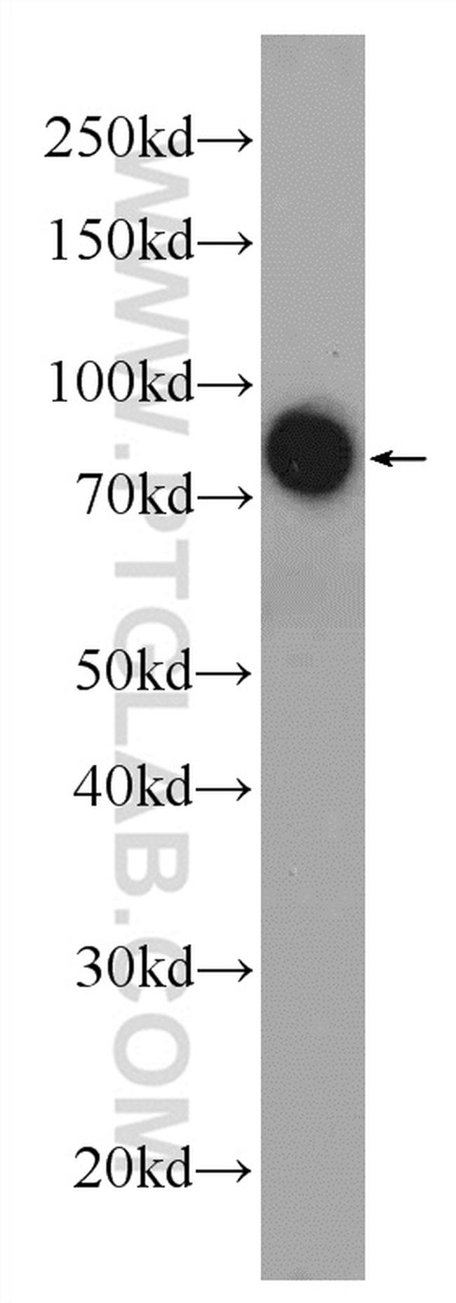 AFM Antibody in Western Blot (WB)