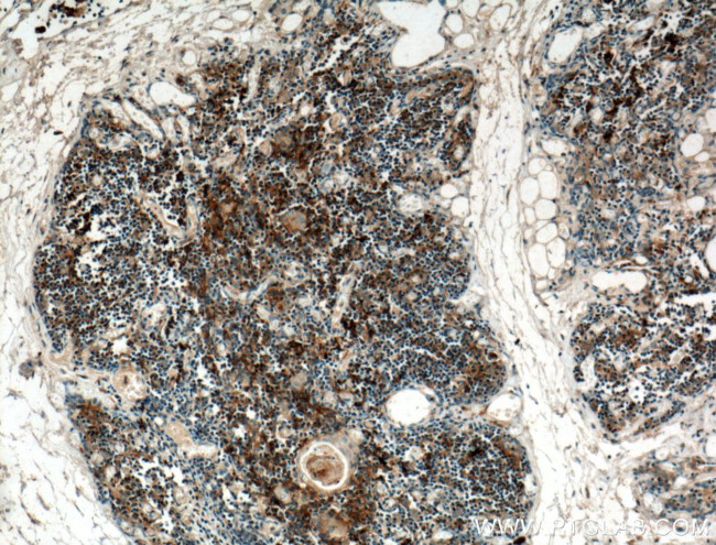 CCL25/TECK Antibody in Immunohistochemistry (Paraffin) (IHC (P))