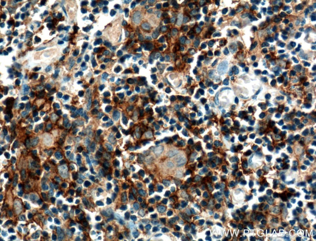 CCL25/TECK Antibody in Immunohistochemistry (Paraffin) (IHC (P))