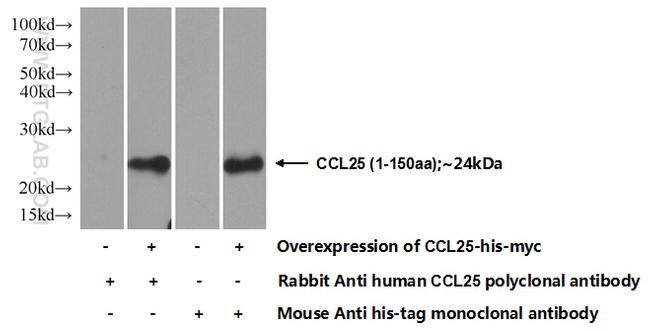 CCL25/TECK Antibody in Western Blot (WB)