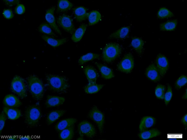 FER Antibody in Immunocytochemistry (ICC/IF)