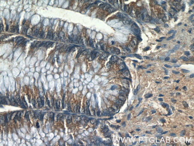 FER Antibody in Immunohistochemistry (Paraffin) (IHC (P))