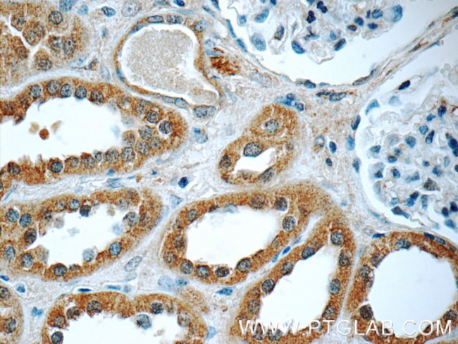 FER Antibody in Immunohistochemistry (Paraffin) (IHC (P))