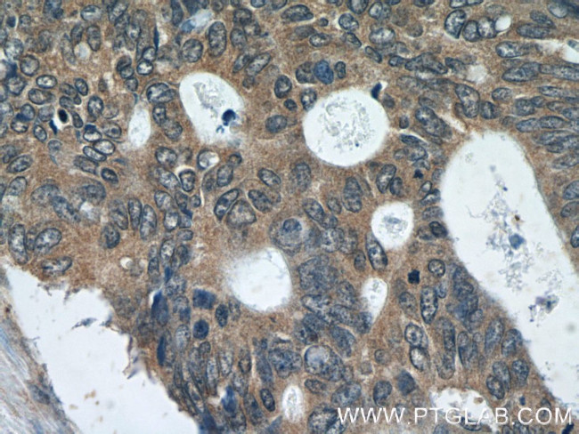 FER Antibody in Immunohistochemistry (Paraffin) (IHC (P))