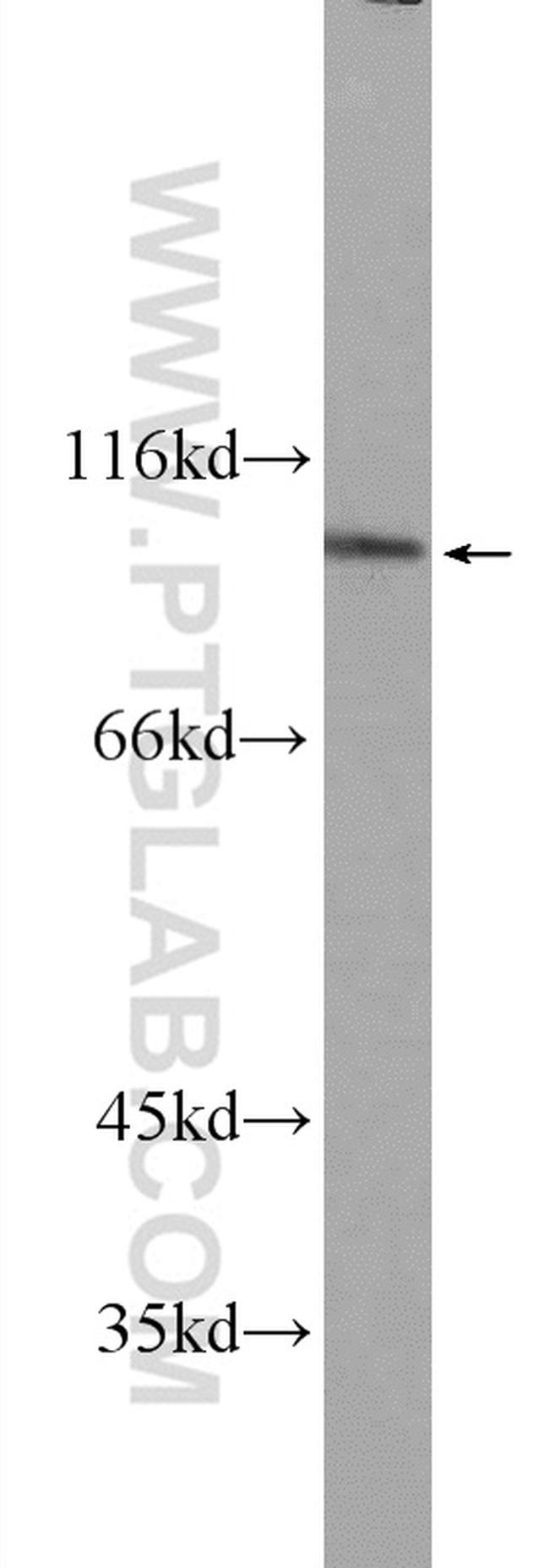 FER Antibody in Western Blot (WB)