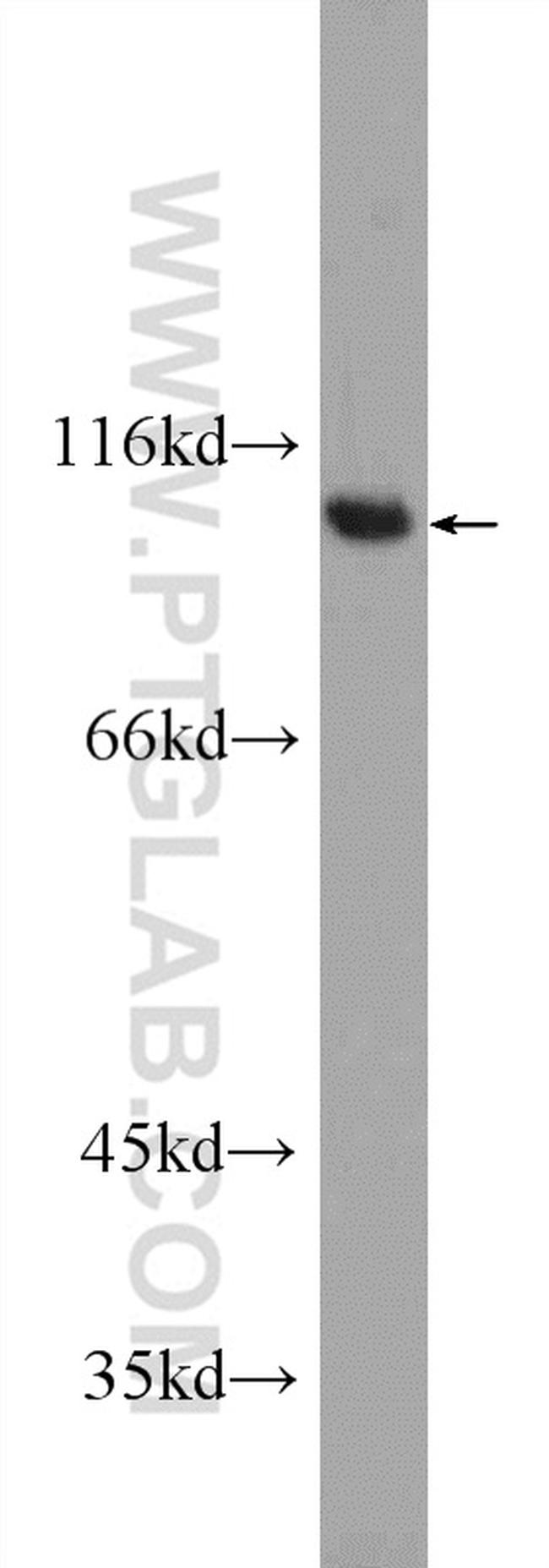 FER Antibody in Western Blot (WB)