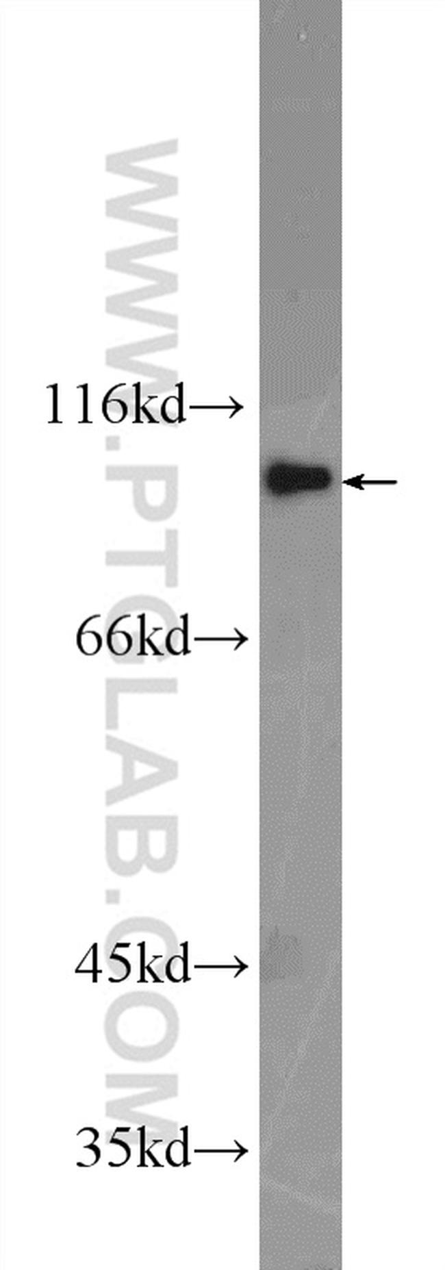 FER Antibody in Western Blot (WB)