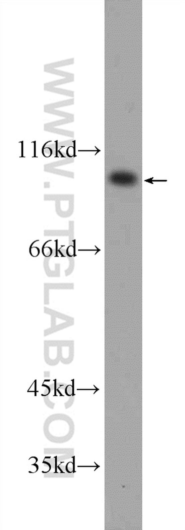 FER Antibody in Western Blot (WB)