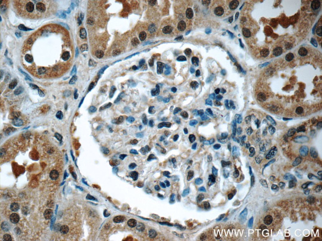 EXOSC7 Antibody in Immunohistochemistry (Paraffin) (IHC (P))