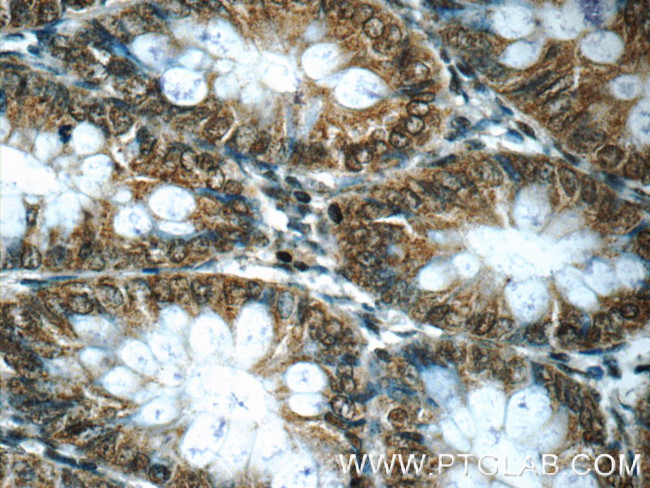 EXOSC7 Antibody in Immunohistochemistry (Paraffin) (IHC (P))