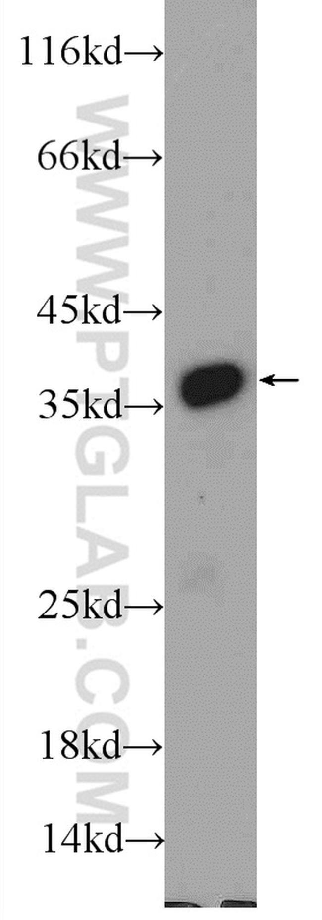 EXOSC7 Antibody in Western Blot (WB)