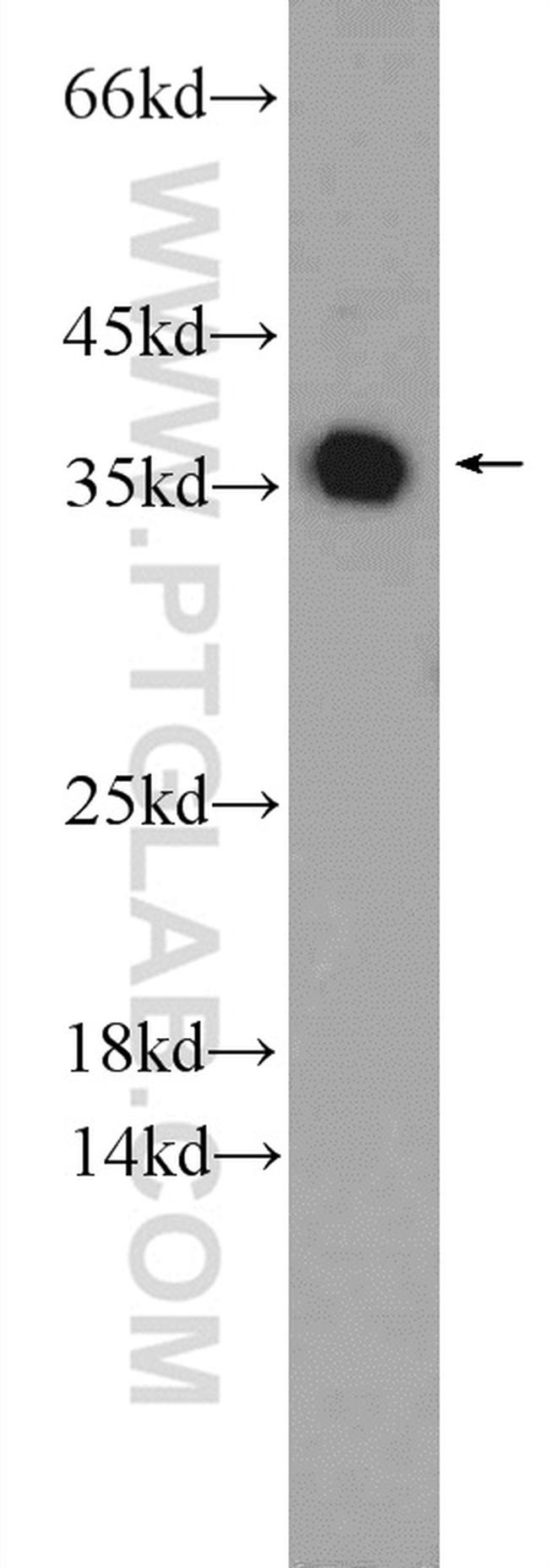 EXOSC7 Antibody in Western Blot (WB)