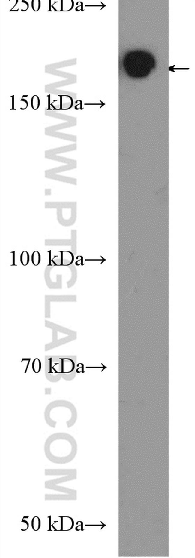 MLH3 Antibody in Western Blot (WB)